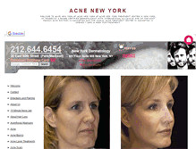 Tablet Screenshot of acnenewyork.org